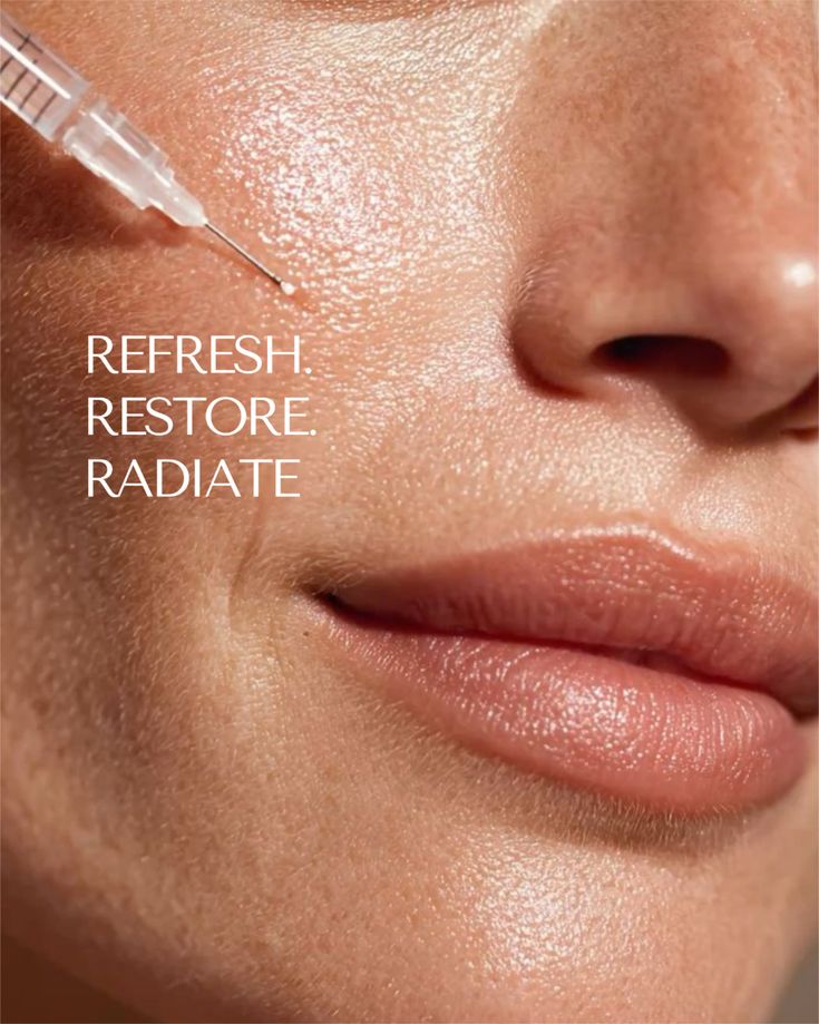 Dermal Fillers
