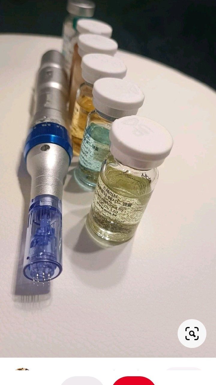 Microneedling treatment
